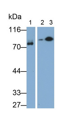 Monoclonal Antibody to Complement 1 Inhibitor (C1INH)
