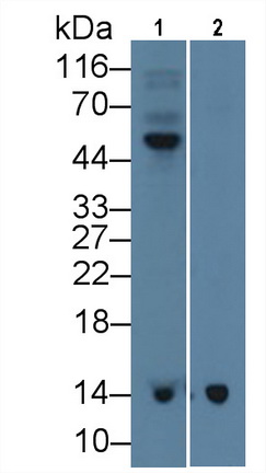 Monoclonal Antibody to Beta-2-Microglobulin (b2M)