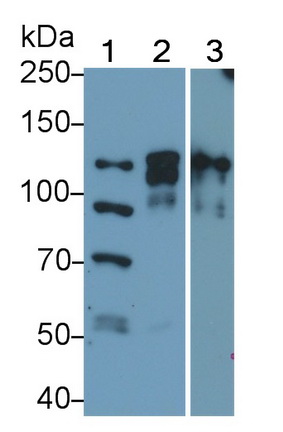 Monoclonal Antibody to Poly ADP Ribose Polymerase (PARP)