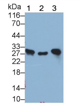 Monoclonal Antibody to Galectin 3 (GAL3)