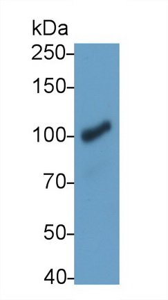 Monoclonal Antibody to Complement Component 3a (C3a)