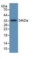 Monoclonal Antibody to Complement Component 5a (C5a)