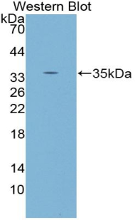 Monoclonal Antibody to Protein Kinase C Gamma (PKCg)