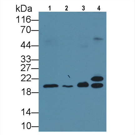 Monoclonal Antibody to Neurokinin A (NKA)