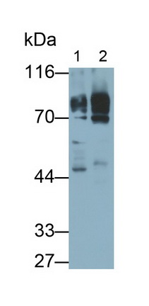 Monoclonal Antibody to Protein Kinase C Epsilon (PKCe)