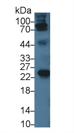 Monoclonal Antibody to Apolipoprotein A1 (APOA1)