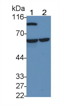 Monoclonal Antibody to Tissue Plasminogen Activator (tPA)