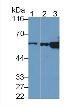 Monoclonal Antibody to Cytokeratin 7 (CK7)