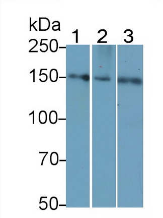 Monoclonal Antibody to Procollagen III N-Terminal Propeptide (PIIINP)
