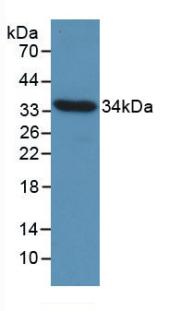 Monoclonal Antibody to Cyclin D1 (CCND1)