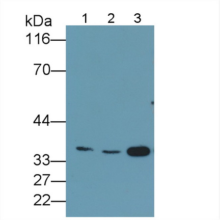Monoclonal Antibody to Proliferating Cell Nuclear Antigen (PCNA)