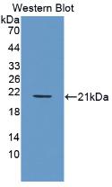 Monoclonal Antibody to Platelet Derived Growth Factor BB (PDGF BB)