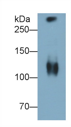 Monoclonal Antibody to Mucin 5 Subtype B (MUC5B)