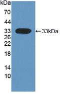 Monoclonal Antibody to Dickkopf Related Protein 1 (DKK1)