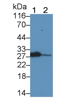 Monoclonal Antibody to Programmed Cell Death Protein 1 (PD1)