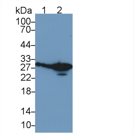 Monoclonal Antibody to Programmed Cell Death Protein 1 (PD1)