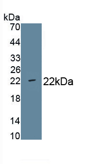 Monoclonal Antibody to Cluster Of Differentiation 276 (CD276)