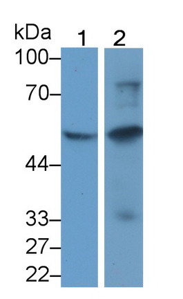 Monoclonal Antibody to Programmed Cell Death Protein 1 Ligand 1 (PDL1)