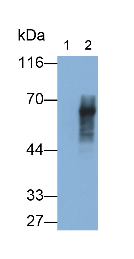 Monoclonal Antibody to Amylin