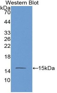 Monoclonal Antibody to Mannose Associated Serine Protease 2 (MASP2)