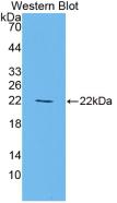 Monoclonal Antibody to Peroxisome Proliferator Activated Receptor Gamma (PPARg)