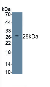 Monoclonal Antibody to Dickkopf Related Protein 2 (DKK2)