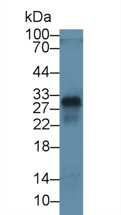 Monoclonal Antibody to Cluster Of Differentiation 8a (CD8a)