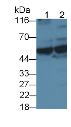 Monoclonal Antibody to Cluster Of Differentiation 4 (CD4)