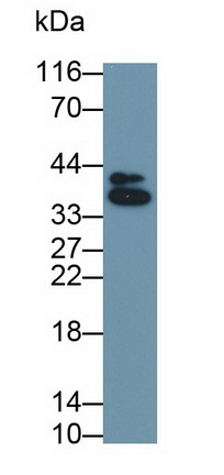 Monoclonal Antibody to Cluster Of Differentiation 1a (CD1a)
