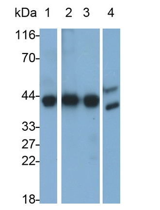 Monoclonal Antibody to Aspartate Aminotransferase (AST)
