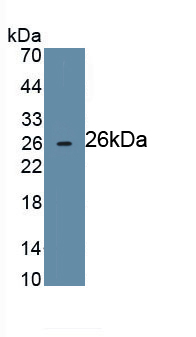 Monoclonal Antibody to Cluster Of Differentiation 72 (CD72)