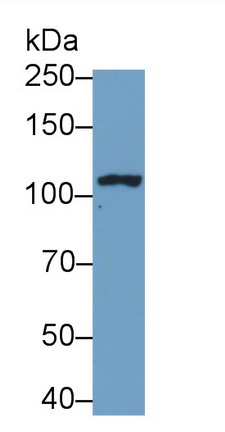 Monoclonal Antibody to Probable ATP-dependent RNA Helicase DDX58 (DDX58)