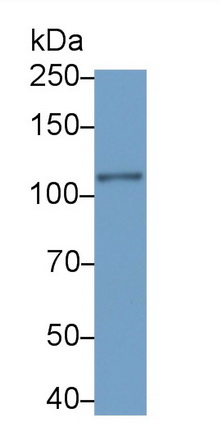 Monoclonal Antibody to Probable ATP-dependent RNA Helicase DDX58 (DDX58)