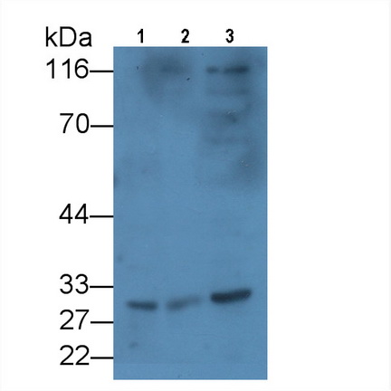 Monoclonal Antibody to Killer Cell Immunoglobulin Like Receptor 2DS4 (KIR2DS4)