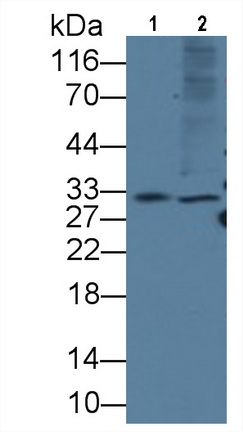Monoclonal Antibody to Killer Cell Immunoglobulin Like Receptor 2DS4 (KIR2DS4)