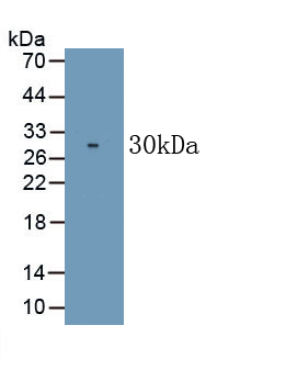 Monoclonal Antibody to Cluster Of Differentiation 226 (CD226)