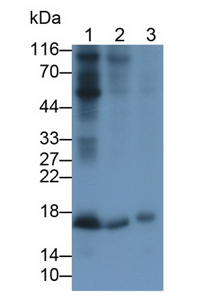 Monoclonal Antibody to Interleukin 21 (IL21)