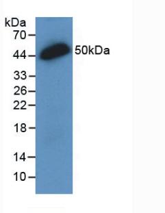 Monoclonal Antibody to Interleukin 28A (IL28A)
