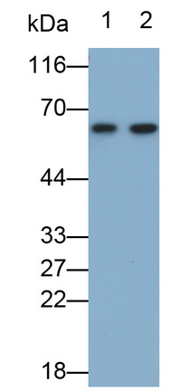 Monoclonal Antibody to Alpha-1-Antitrypsin (a1AT)