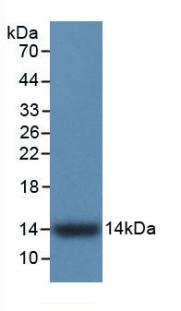Monoclonal Antibody to S100 Calcium Binding Protein A9 (S100A9)