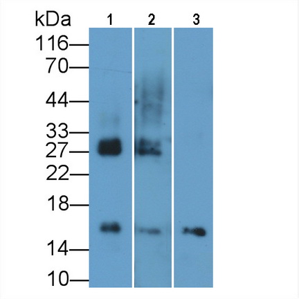 Monoclonal Antibody to S100 Calcium Binding Protein A9 (S100A9)