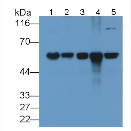 Monoclonal Antibody to Cluster Of Differentiation 5 (CD5)