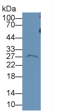 Monoclonal Antibody to Complement Factor D (CFD)