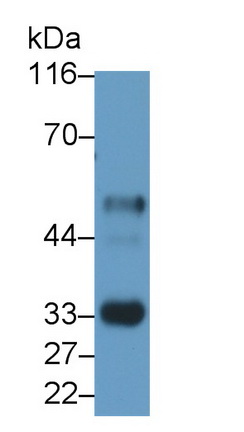 Monoclonal Antibody to Interleukin 2 Receptor Alpha (IL2Ra)