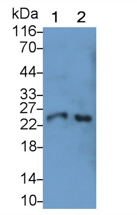 Monoclonal Antibody to Cathepsin S (CTSS)