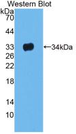 Monoclonal Antibody to Leucine Rich Alpha-2-Glycoprotein 1 (LRG1)