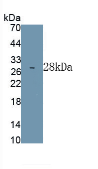 Monoclonal Antibody to Cluster Of Differentiation 34 (CD34)
