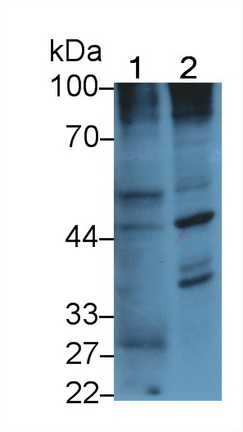 Monoclonal Antibody to Pigment Epithelium Derived Factor (PEDF)
