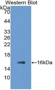 Monoclonal Antibody to Fatty Acid Binding Protein 5 (FABP5)