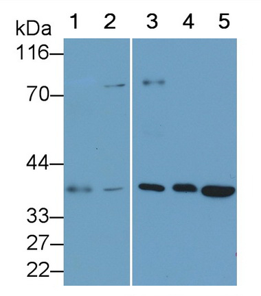 Monoclonal Antibody to Interleukin 34 (IL34)
